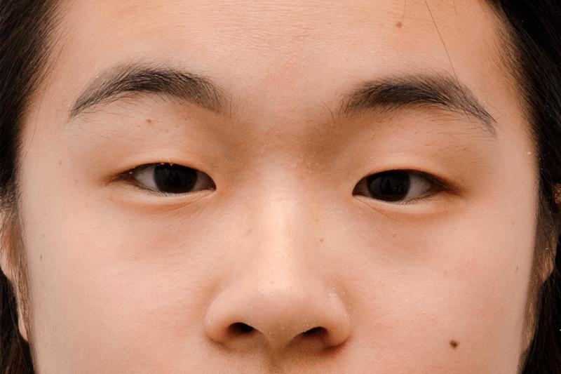 Азиатский разрез глаз