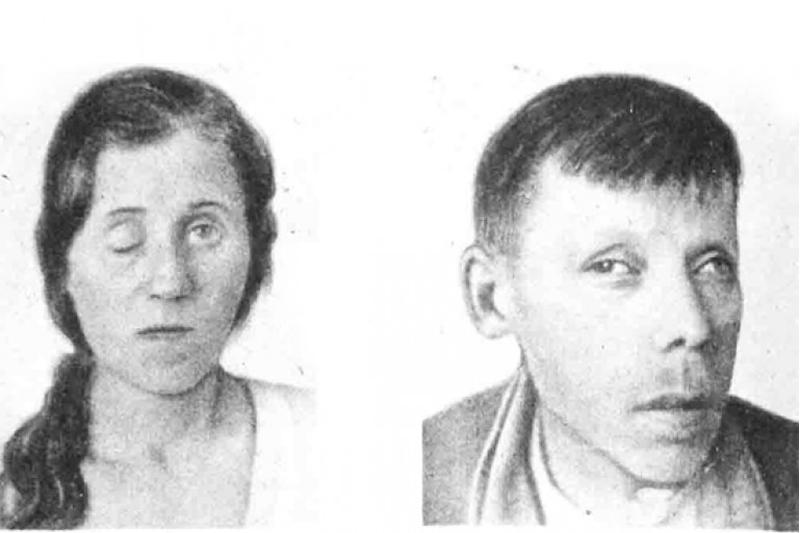 Нейросифилис Нейросифилис