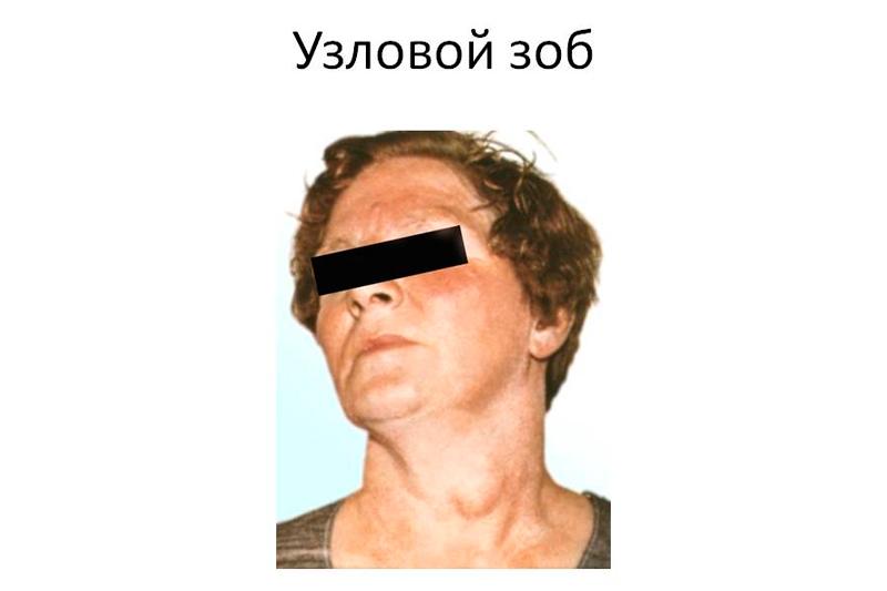 Хавал работа узловая