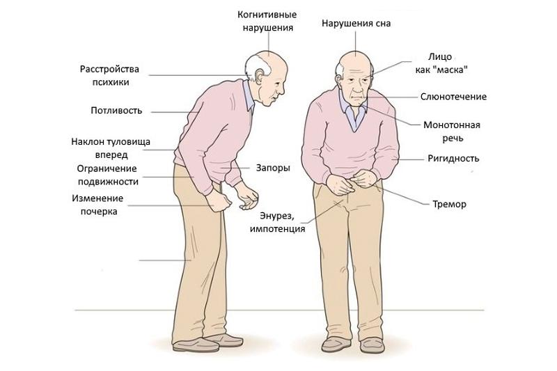 Болезнь Паркинсона