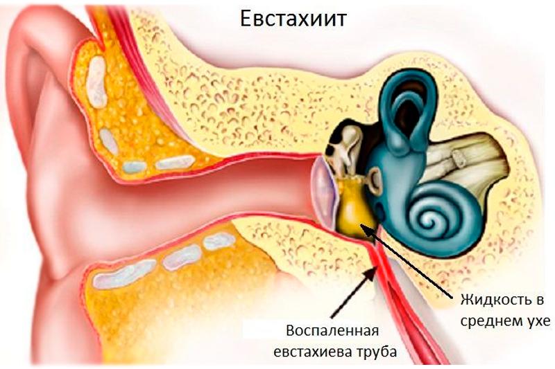 Евстахиит Евстахиит