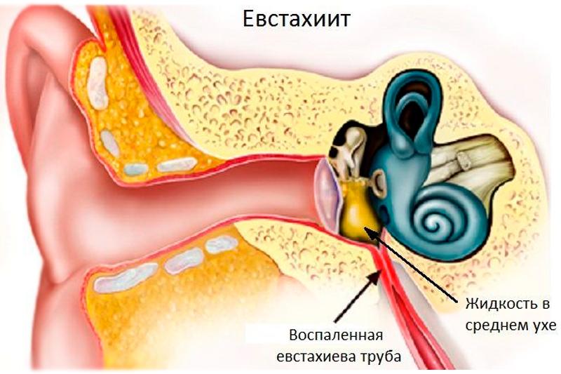 Евстахиит