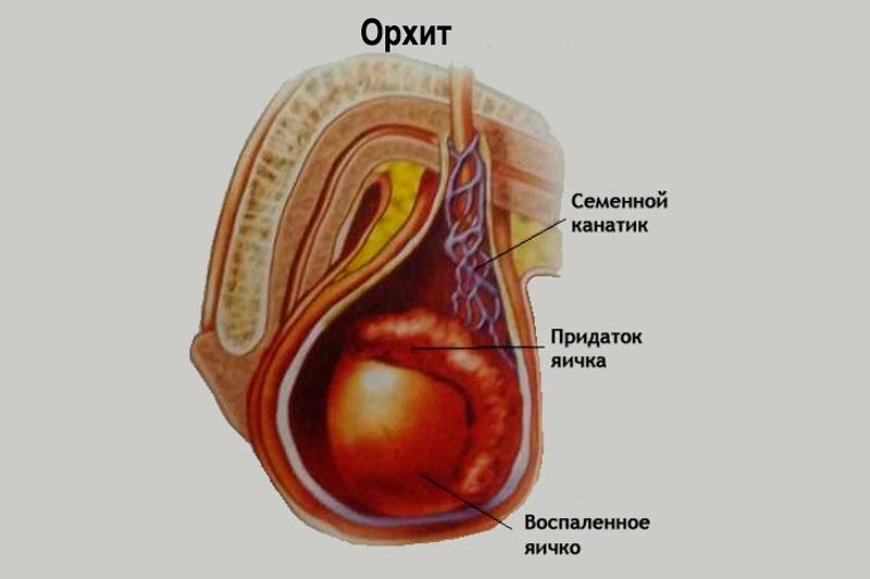 Орхит