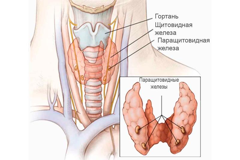 Гипопаратиреоз