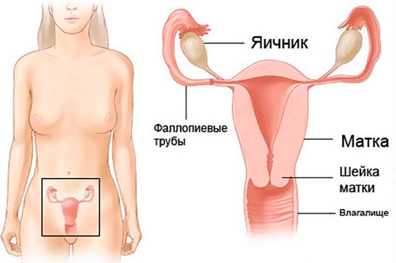 Саркома влагалища Саркома влагалища