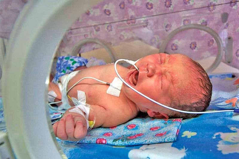 Асфиксия новорожденных: причины, симптомы, диагностика и лечение