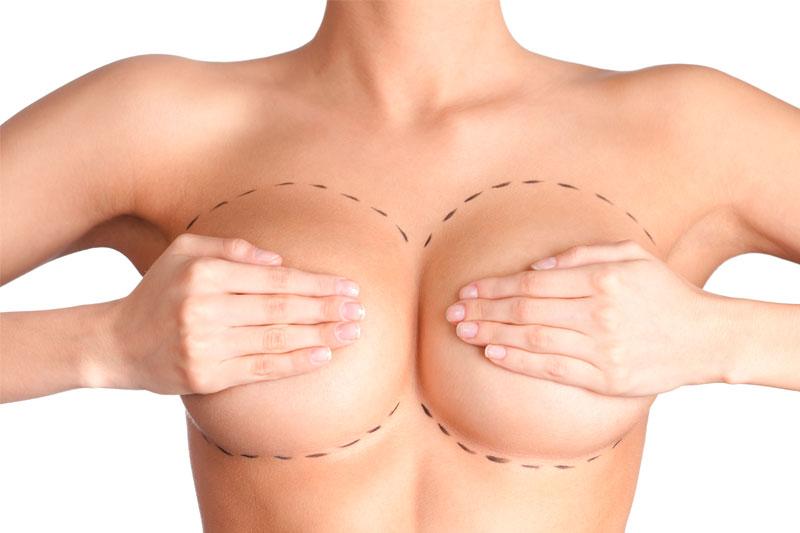 Реконструкция груди с использованием собственных тканей
