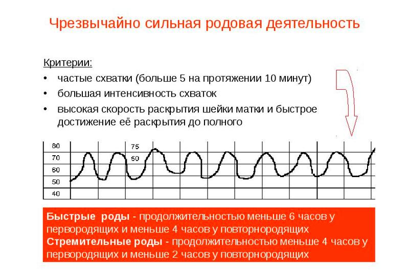 Как выглядят схватки на КТГ