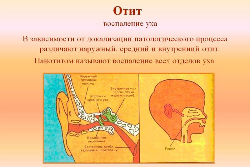 Отит наружного уха